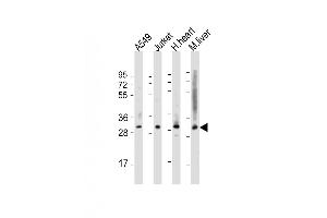 Western Blot at 1:2000 dilution Lane 1: A549 whole cell lysate Lane 2: Jurkat whole cell lysate Lane 3: human heart lysate Lane 4: mouse liver lysate Lysates/proteins at 20 ug per lane. (ATF5 抗体  (C-Term))