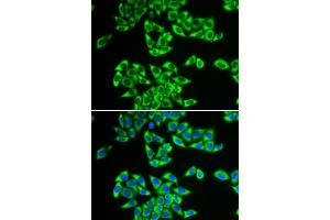 Immunofluorescence analysis of HeLa cells using DDX3X antibody (ABIN5973285). (DDX3X 抗体)