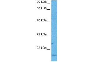 Host:  Rabbit  Target Name:  ND6  Sample Tissue:  Human Lung Tumor  Antibody Dilution:  1ug/ml (MT-ND6 抗体  (Middle Region))