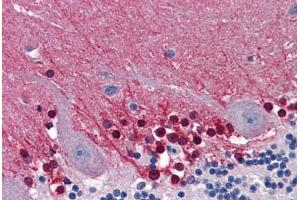Human Brain, Cerebellum: Formalin-Fixed, Paraffin-Embedded (FFPE) (CBS 抗体  (AA 1-101))
