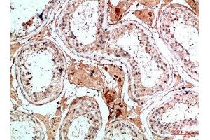 Immunohistochemistry (IHC) image for anti-Nanos Homolog 1 (NANOS1) (AA 151-200) antibody (ABIN7184522)