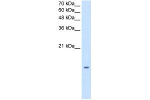 WB Suggested Anti-MGST2 Antibody Titration:  1.