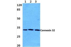 Western blot analysis of Connexin 32 (L115) Antibody at 1/500 dilution:  Lane 1: Hela cell lysate. (GJB1 抗体)