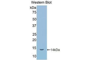 Western blot analysis of the recombinant protein. (IL1R1 抗体  (AA 226-318))