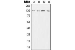 Western blot analysis of CD131 expression in HL60 (A), TF1 (B), SP2/0 (C), H9C2 (D) whole cell lysates. (CD131 抗体  (C-Term))