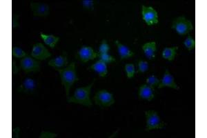 Immunofluorescence staining of SH-SY5Y cells with ABIN7163961 at 1:50, counter-stained with DAPI. (Kv2.1/KCNB1 抗体  (AA 535-765))