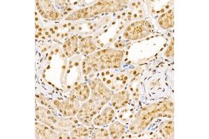 Immunohistochemistry of paraffin-embedded mouse kidney using UBB Rabbit pAb (ABIN6130181, ABIN6149775, ABIN6149776 and ABIN6222958) at dilution of 1:200 (40x lens). (UBASH3B 抗体  (AA 1-300))
