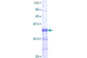 TCF7L1 Protein (AA 489-586) (GST tag)