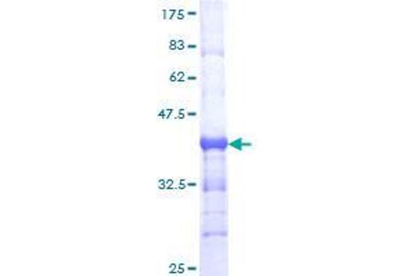 TCF7L1 Protein (AA 489-586) (GST tag)