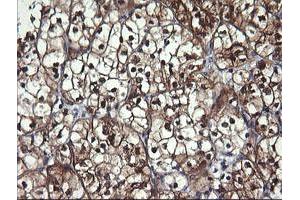 Image no. 1 for anti-butyrobetaine (Gamma), 2-Oxoglutarate Dioxygenase (Gamma-butyrobetaine Hydroxylase) 1 (BBOX1) antibody (ABIN1496819) (BBOX1 抗体)