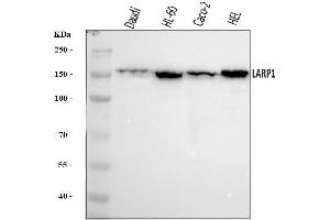 Western blot analysis of LARP1 using anti-LARP1 antibody (ABIN7599861).
