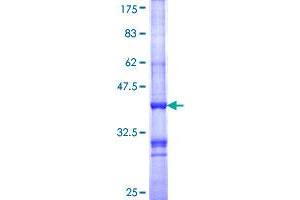 Image no. 1 for Melanocortin 1 Receptor (MC1R) (AA 1-100) protein (GST tag) (ABIN1310505)