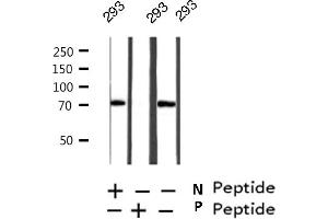Western blot analysis on 293 cell lysate using Phospho-RIPK2(Ser176) Antibody (RIPK2 抗体  (pSer176))