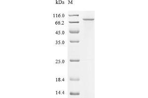 Bicaudal C Homolog 1 (BICC1) (AA 1-549) protein (His-SUMO Tag)