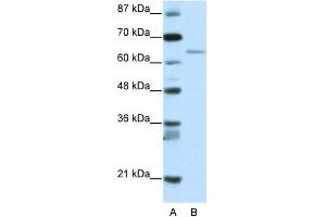 WB Suggested Anti-RFX5 Antibody Titration:  2. (RFX5 抗体  (N-Term))