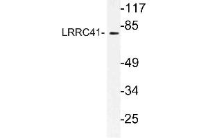 Western blot (WB) analysis of LRRC41 antibody in extracts from rat heart cells. (LRRC41 抗体)