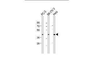All lanes : Anti-ST3GAL4 Antibody (N-Term) at 1:1000-1:2000 dilution Lane 1: PC-3 whole cell lysate Lane 2: SK-OV-3 whole cell lysate Lane 3: Hela whole cell lysate Lysates/proteins at 20 μg per lane. (ST3GAL4 抗体  (AA 26-57))