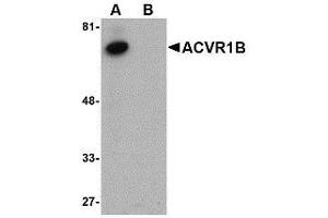 Western blot analysis of ACVR1B in human kidney tissue lysate with AP30015PU-N ACVR1B antibody at 1 μg/ml in (A) the absence and (B) the presence of blocking peptide. (Activin A Receptor Type IB/ALK-4 抗体  (C-Term))