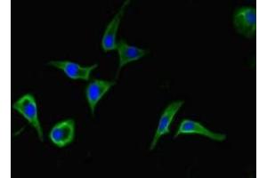 Immunofluorescent analysis of Hela cells using ABIN7145002 at dilution of 1:100 and Alexa Fluor 488-congugated AffiniPure Goat Anti-Rabbit IgG(H+L) (DHX33 抗体  (AA 116-357))
