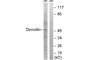 Immunohistochemistry analysis of paraffin-embedded human heart tissue using Dematin (Ab-403) antibody. (Dematin 抗体  (Ser403))