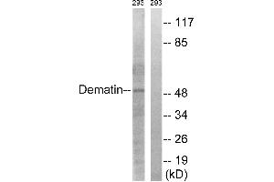Immunohistochemistry analysis of paraffin-embedded human heart tissue using Dematin (Ab-403) antibody.