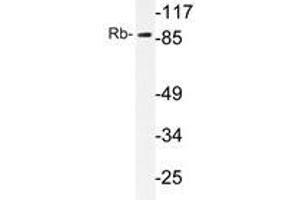 Western blot analysis of Rb antibody in extracts from HeLa cells. (Retinoblastoma 1 抗体)