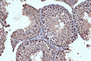 Immunohistochemistry of paraffin-embedded mouse testis using HD Rabbit mAb (ABIN7267714) at dilution of 1:100 (40x lens). (HDAC8 抗体)