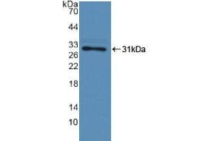 Western blot analysis of recombinant Human F13A1. (F13A1 抗体  (AA 107-345))