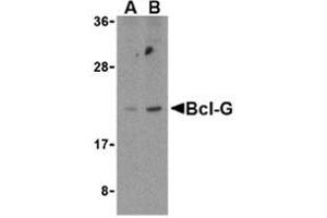 Western blot analysis of Bcl-G in U937 cell lysates with Bcl-G antibody at (A) 2. (BCL2L14 抗体  (C-Term))