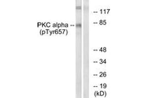 Western blot analysis of extracts from COLO205 cells, using PKC alpha (Phospho-Tyr657) Antibody. (PKC alpha 抗体  (pTyr657))