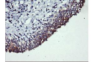 Image no. 3 for anti-Phosphatidylinositol-4-Phosphate 3-Kinase, Catalytic Subunit Type 2 beta (PIK3C2B) antibody (ABIN1500198)