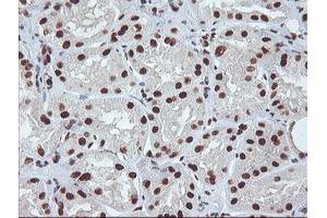 Immunohistochemistry (IHC) image for anti-Exosome Component 7 (EXOSC7) antibody (ABIN1498140)