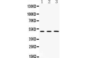Western blot analysis of CNPase expression in rat  brain extract ( Lane 1), mouse brain extract ( Lane 2) and HELA whole cell lysates ( Lane 3). (Cnpase 抗体  (Middle Region))