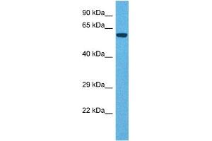 Host:  Rabbit  Target Name:  TDO2  Sample Tissue:  Human Liver Tumor  Antibody Dilution:  1ug/ml (TDO2 抗体  (N-Term))