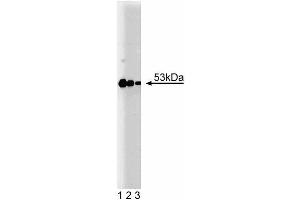 Western blot analysis of PKA RIIbeta on human endothelial lysate (left). (PRKAR2B 抗体  (AA 1-418))