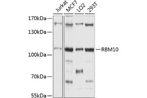 Western blot analysis of extracts of various cell lines, using RBM10 antibody (ABIN1682489, ABIN3018697, ABIN3018698 and ABIN6220546) at 1:1000 dilution.