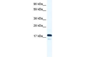 WB Suggested Anti-TAF9 Antibody Titration:  0. (TAF9 抗体  (N-Term))