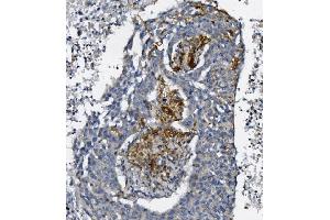 IHC analysis of AFAP/AFAP1 using anti-AFAP/AFAP1 antibody (ABIN7601861).