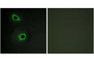 Immunofluorescence analysis of COS7 cells, using Collagen VII alpha1 Antibody. (COL7A1 抗体  (AA 1841-1890))