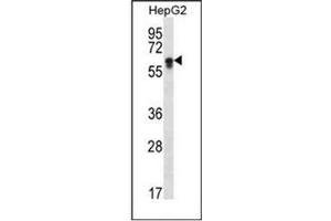 Western blot analysis of CYP2S1 Antibody (C-term) in HepG2 cell line lysates (35ug/lane).