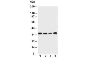 Western blot testing of MyD88 antibody and Lane 1:  rat spleen (MYD88 抗体  (Middle Region))