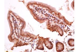 Paraformaldehyde-fixed, paraffin embedded mouse intestine, Antigen retrieval by boiling in sodium citrate buffer (pH6) for 15min, Block endogenous peroxidase by 3% hydrogen peroxide for 30 minutes, Blocking buffer (normal goat serum) at 37°C for 20min, Antibody incubation with Rabbit Anti-APOC3 Polyclonal Antibody, Unconjugated  at 1:200 overnight at 4°C, followed by a conjugated secondary for 90 minutes and DAB staining. (APOC3 抗体  (AA 41-80))