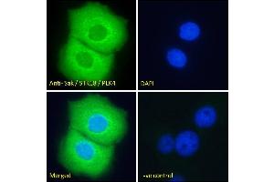 ABIN184701 Immunofluorescence analysis of paraformaldehyde fixed A431 cells, permeabilized with 0. (PLK4 抗体  (N-Term))