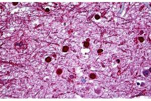 Human Brain, Cortex: Formalin-Fixed, Paraffin-Embedded (FFPE) (HMX2 抗体  (AA 125-224))