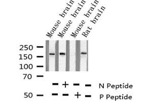 Western Blotting (WB) image for anti-Glutamate Receptor, Ionotropic, N-Methyl D-Aspartate 2B (GRIN2B) (pTyr1474) antibody (ABIN6255815)