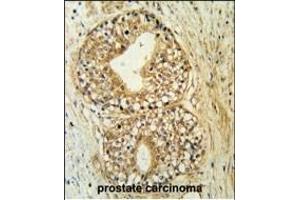 Immunohistochemistry (Paraffin-embedded Sections) (IHC (p)) image for anti-ATPase, class VI, type 11C (ATP11C) (AA 589-616) antibody (ABIN651638)