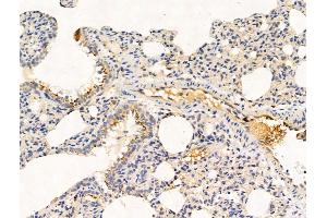 anti-Gastrin-Releasing Peptide (GRP) (Internal Region) antibody