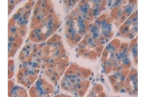Detection of CHD3 in Mouse Stomach Tissue using Polyclonal Antibody to Chromodomain Helicase DNA Binding Protein 3 (CHD3) (CHD3 抗体  (AA 1613-1820))