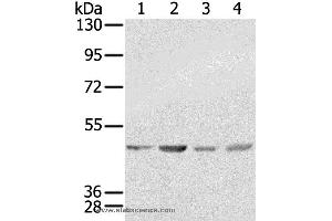 Western blot analysis of K562, 231, Raji and hela  cell, using SSB Polyclonal Antibody at dilution of 1:400 (SSB 抗体)
