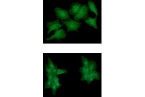 anti-EPH Receptor A2 (EPHA2) (AA 27-537) antibody